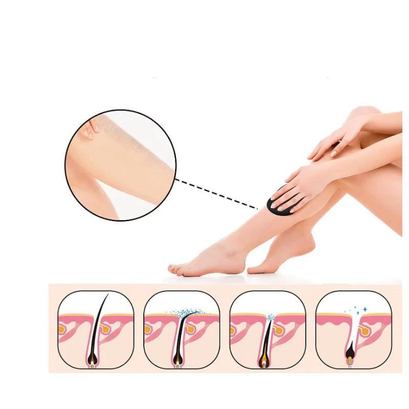 Dispozitiv de Epilare At Performance, prin Frecare cu Cristale, Pentru Indepartarea Parului si Exfoliere, Reutilizabil, Fara Durere